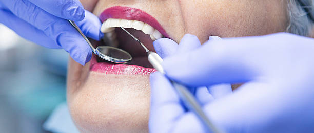 Best Emergency Dental Care for Sports Injuries in Pacific Grove, CA